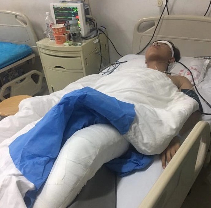 突发新闻：曼彻斯特撞车事故：警察在“与被盗汽车正面相撞”后入院治疗